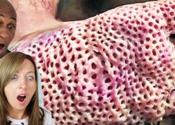 ultimate trypophobia test